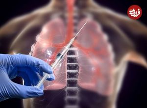 ببینید؛ محققان ایرانی واکسن سرطان ریه را ساختند