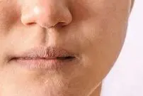 این گروه در سنین پایین پیر می‌شوند؛راه نجات از پیری زودرس چیست؟