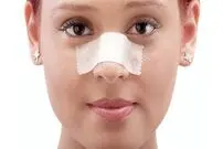 همه چیز درباره‌ی جراحی زیبایی بینی!
