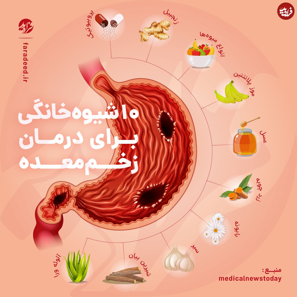 اینفوگرافی/ ۱۰ شیوه خانگی برای درمان زخم معده