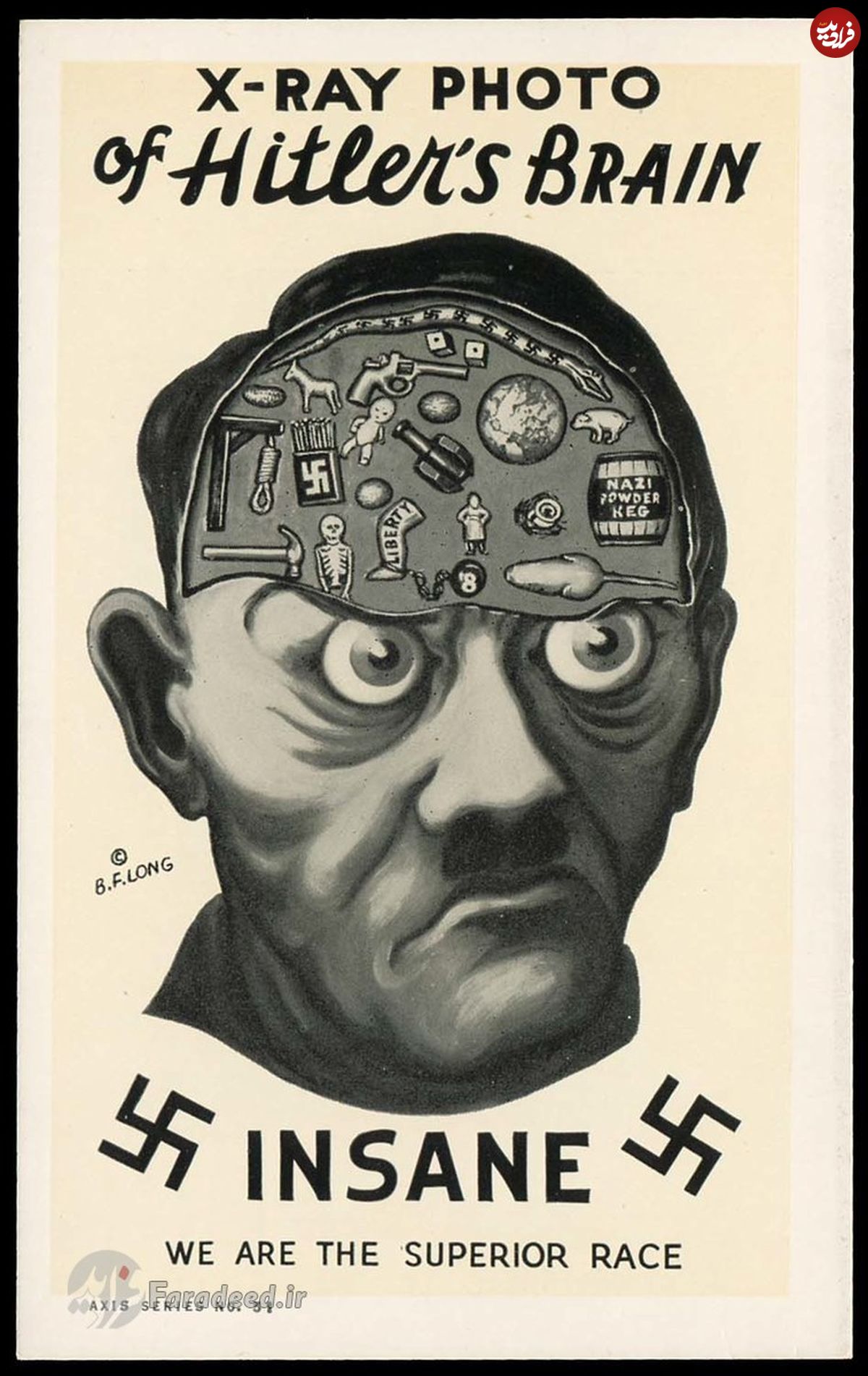 عکس/ ایکس ری از مغز هیتلر