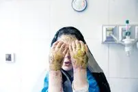 اسیدپاشی در خیابان دامپزشکی تهران
