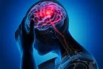 خبر خوب درباره عوارض سکته مغزی