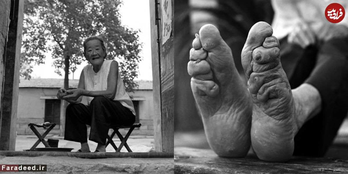 (تصاویر) بازماندگان زنان پا کوچک در چین