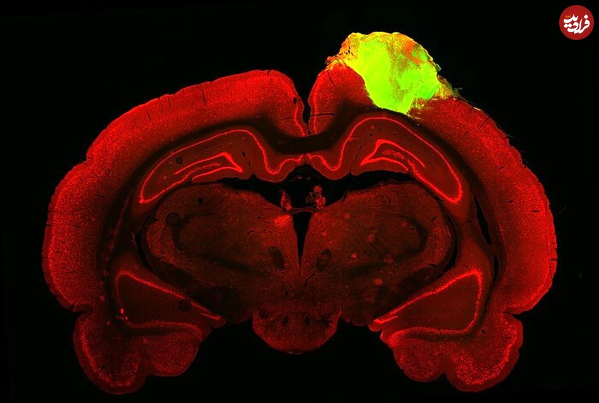 دستاورد بزرگ محققان؛ پیوند بافت مغزی انسان به مغز موش‌