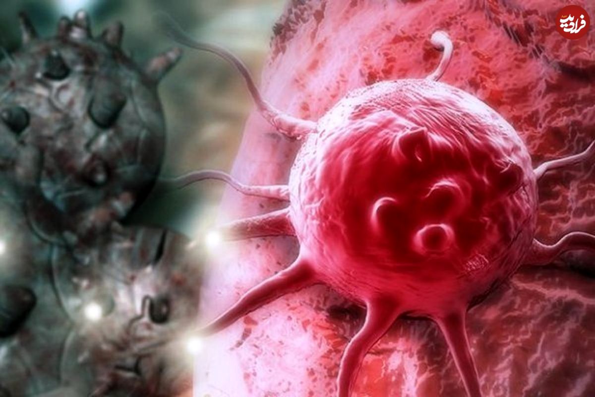 راه‌های تشخیص سرطان پروستات چیست؟