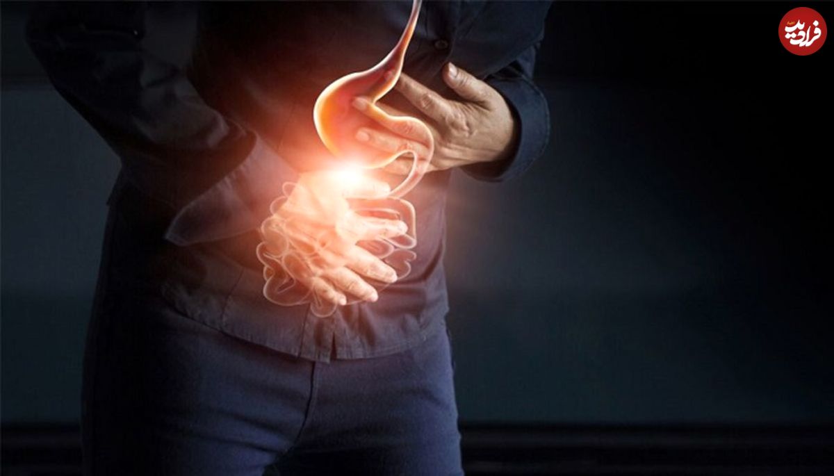 ۱۰ شیوه خانگی برای درمان زخم معده