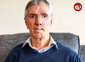 تصاویر؛ بازسازی شگفتانگیز چهره یک دوچرخهسوار پس از تصادف دلخراش