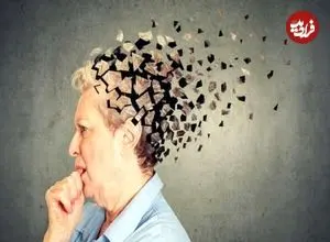 احتمال افزایش خطر زوال عقل با مصرف کربوهیدرات‌های نامناسب