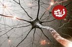 بیماری عجیب مرد ۲۲ ساله؛ بدنش هر چیز سردی را داغ و هر چیز گرمی را سرد حس می‌کند