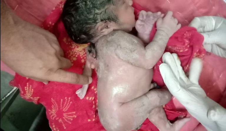 ویدئویی تعجب‌برانگیز از تولد نوزاد پسر با سه دست!