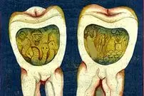 افسانۀ «کرم دندان» چقدر قدمت دارد؟