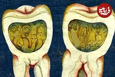 افسانۀ «کرم دندان» چقدر قدمت دارد؟