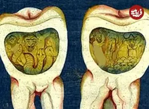 افسانۀ «کرم دندان» چقدر قدمت دارد؟