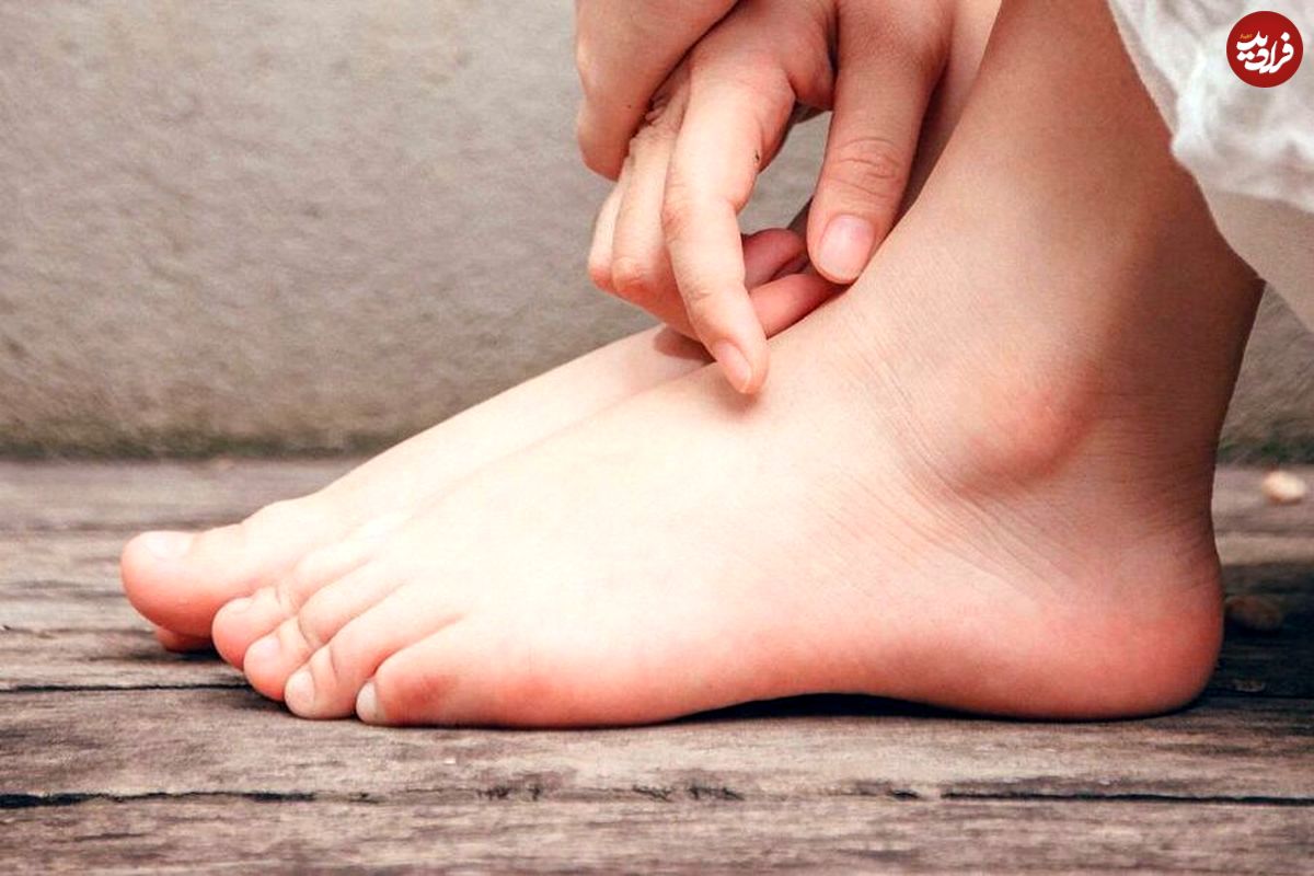 چه عواملی باعث ایجاد ترک پا میشوند؟