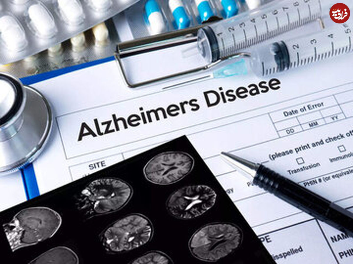 خبرخوش برای آلزایمری ها؛ بالاخره داروی درمان قطعی آلزایمر پیدا شد