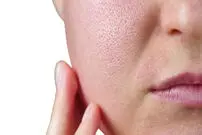چرا منافذ پوست صورت یک شکل نیستند؟ رازهایی که آینه به شما نمی گوید! + اینفوگرافیک