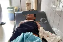 "گاندو" ‌دست ‌پسر‌بچه ‌چابهاری ‌را‌ خورد