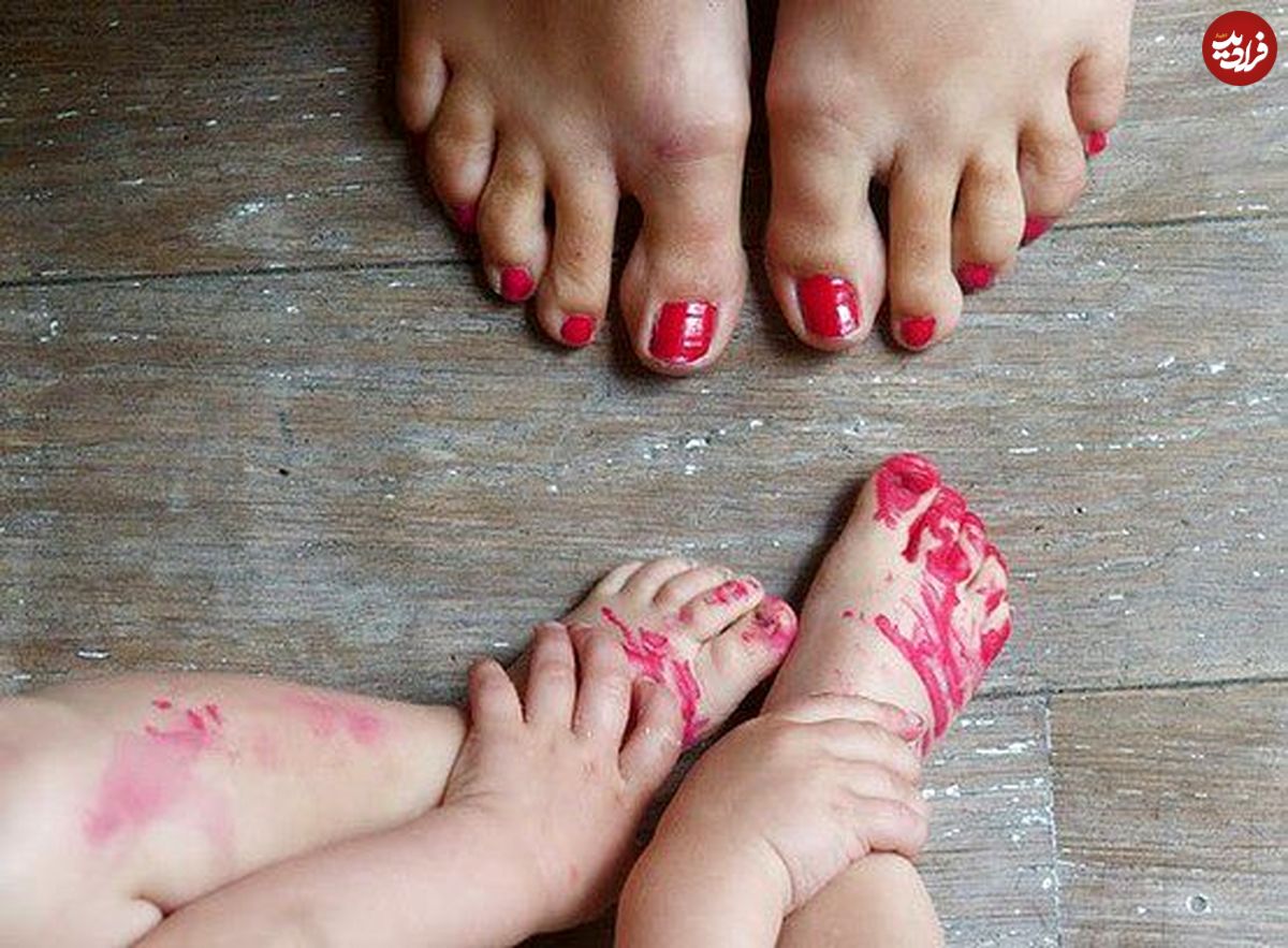 عوارض لاكزدن بر ناخنهای كودكان