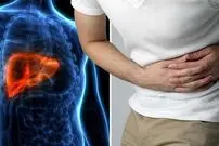 علائم و نشانه‌های پوستی کبد چرب و بیماری‌های کبدی چیست؟