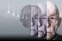 یک گام به جلو برای شناخت بیشتر آلزایمر و درمان آن