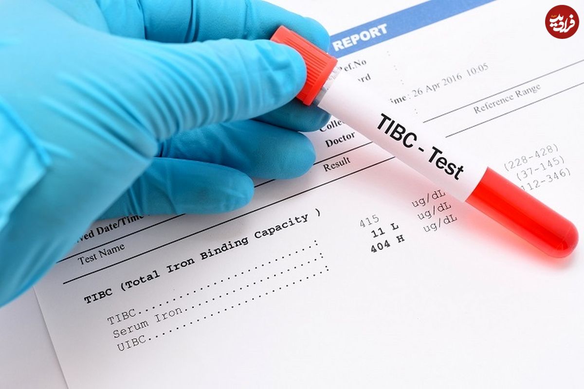 تست TIBC آزمایش خون چیست؟