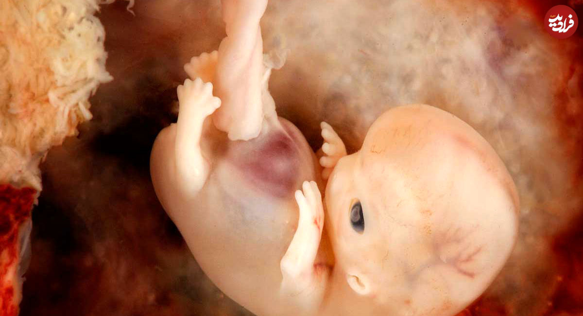 روش تشخیص پسر یا دختر بودن جنین