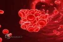 کم خونی و فقر آهن، از علائم و علل ابتلا تا پیشگیری و درمان