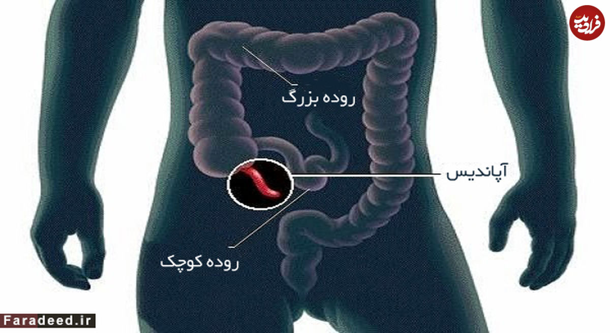 آپاندیس واقعا به چه دردی میخورد؟