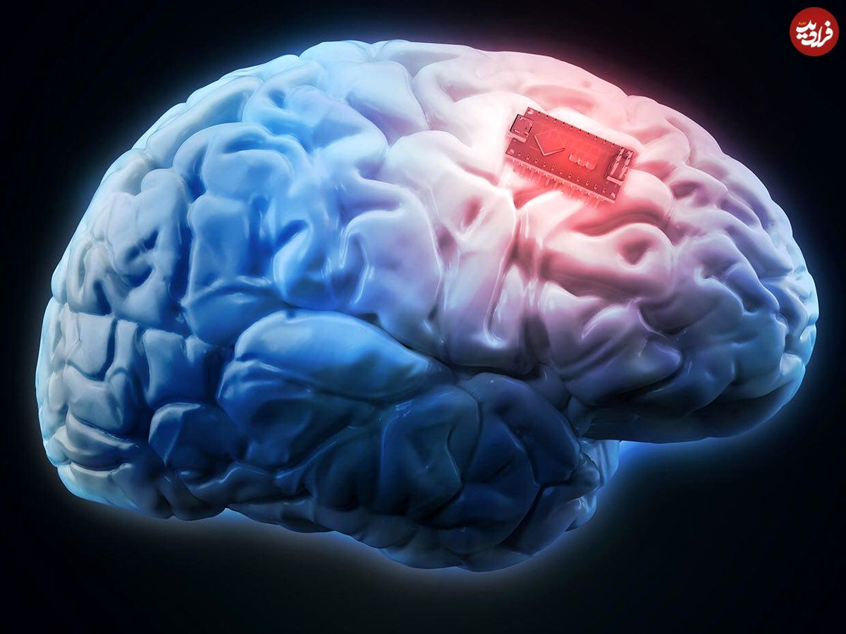 تغییر در رفتار و حرکات انسان با ایمپلنت‌های مغزی