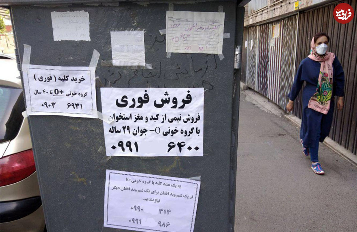 ماجرای خرید و فروش کلیه ایرانیان در عراق!