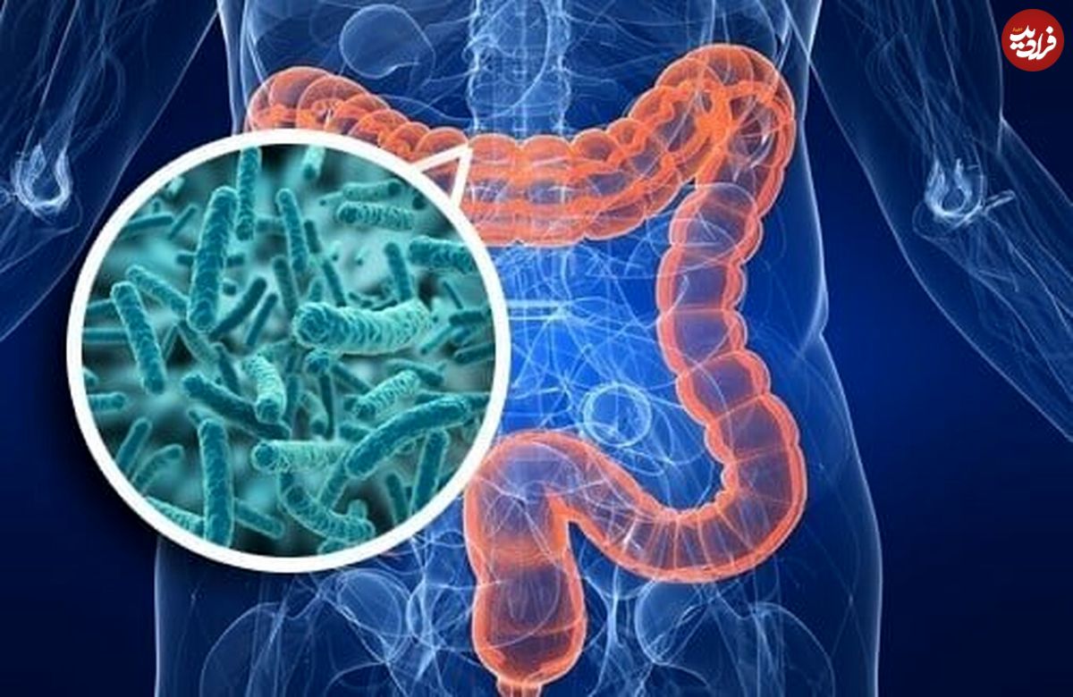 سرطان روده بزرگ چه کسانی را هدف می گیرد؟
