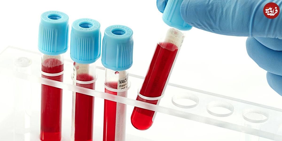 تشخیص ۱۰ نوع سرطان با آزمایش خون
