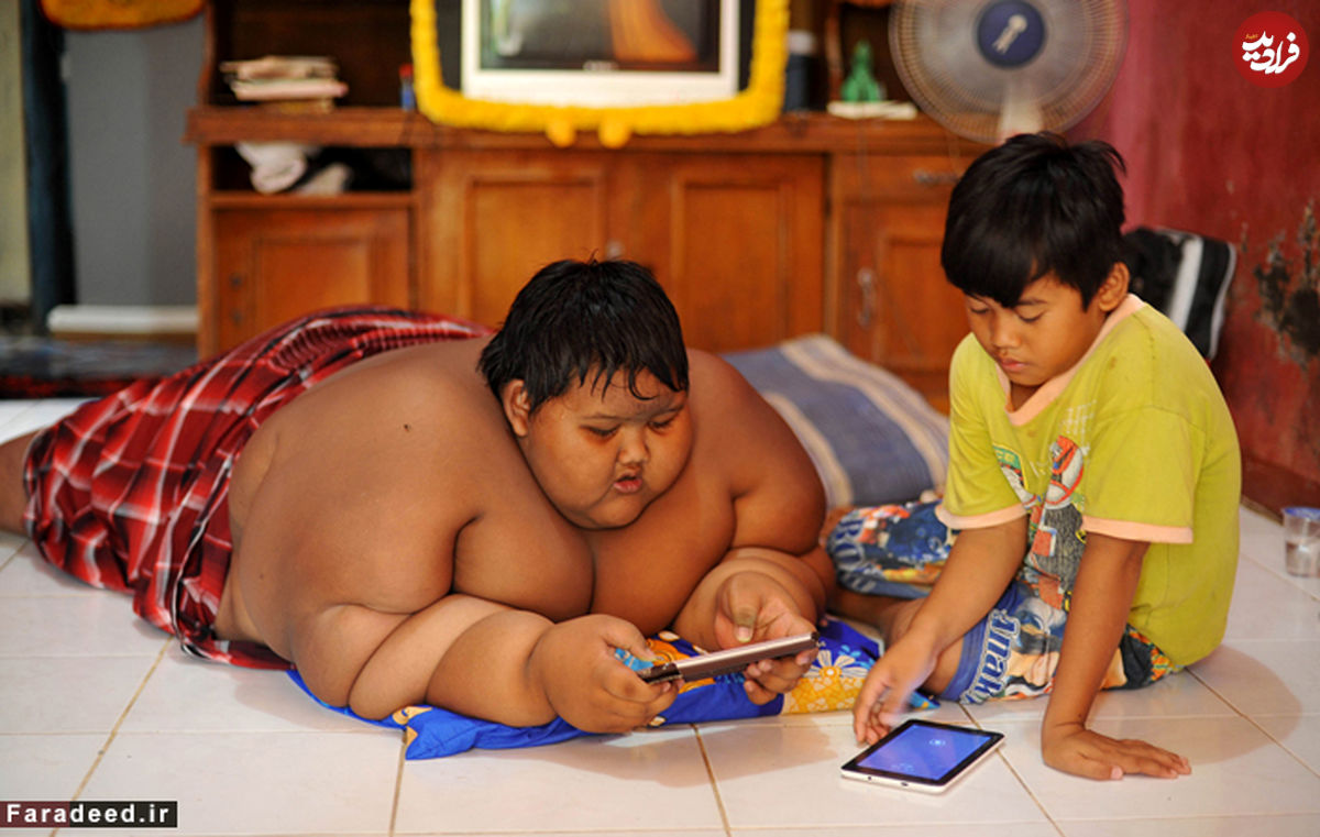 تصاویر/ مرگ در کمین چاق‌ترین پسر جهان