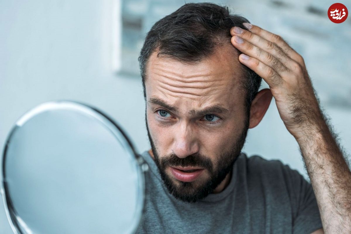 ظاهر موی شما این ۵ بیماری پنهان را لو می‌دهد!