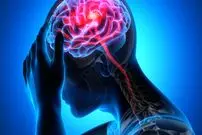 سبقت مردان از زنان در سکته مغزی/ زمان طلایی درمان را جدی بگیرید