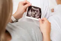 بارداری نادر یک مادر آمریکایی