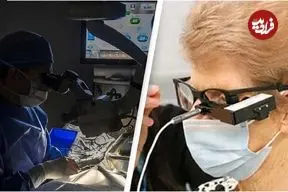 ببینید؛ دیدن پس از ۳۰ سال نابینایی