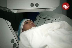 بیماری کیم کارداشیان چیست؟