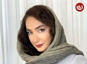 عکس؛ سفر در زمان؛ چهره «هانیه توسلی» در 7 سالگی؛ سال 1365