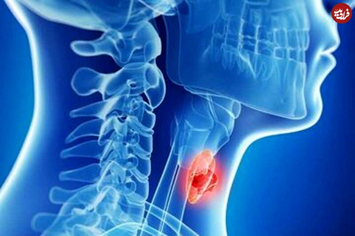غذاهای مفید برای کنترل تیروئید
