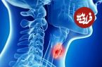 غذاهای مفید برای کنترل تیروئید