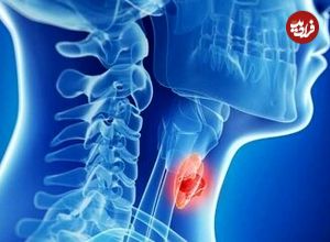 غذاهای مفید برای کنترل تیروئید