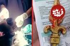 ببینید؛ خارج کردن نیزه فلزی از دهان کودک ۱۱ ساله در ایرانشهر