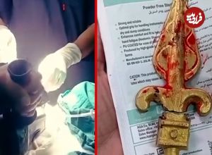 ببینید؛ خارج کردن نیزه فلزی از دهان کودک ۱۱ ساله در ایرانشهر