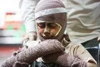 با سوختگی ناشی از حملات جنگی چه کنیم؟