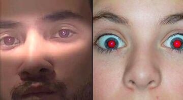قرمزی مردمک چشم در عکس‌ها نشانه کدام بیماری است؟