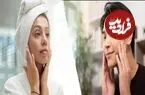 کشف تفاوت شگفت‌انگیز میان پوست زنان و مردان