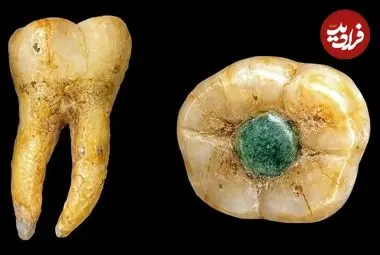 دندان جواهرنشان تمدن مایا که در گواتمالا پیدا شد
