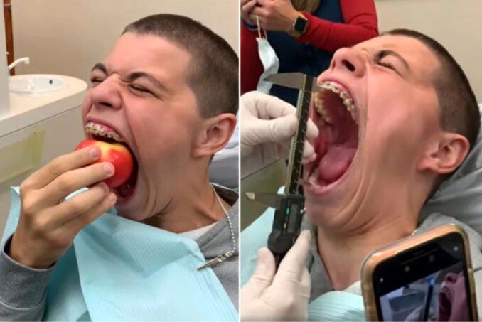 (عکس) رکورد بزرگ‌ترین دهان انسان شکسته شد